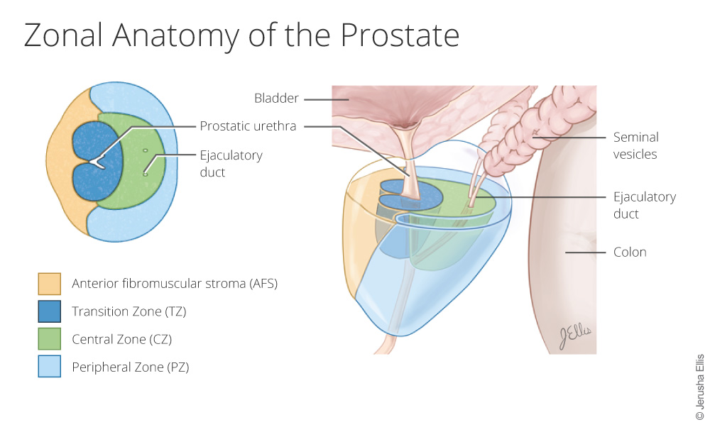 Zonal Anatomy of the Prostate